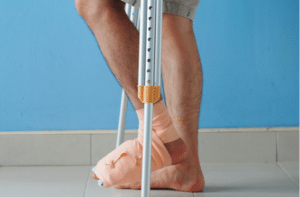 leg splint moving